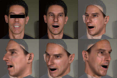 Aus einem 2D-Foto entsteht ein 3D-Modell, das gleichzeitig fehlende Bereiche wie die Augenpartie rekonstruiert. Zähne werden in diesem Modell nicht repräsentiert. Foto: Uni